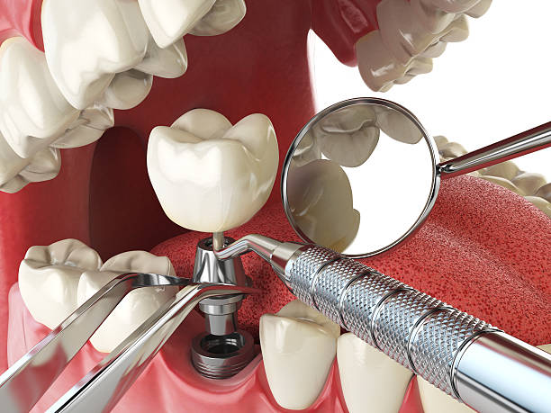 Best Cracked Tooth Emergency Dentist  in Paramount Long Meadow, MD